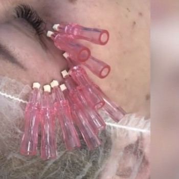 Фото з портфоліо косметолога Ольга Друченко (Київ)