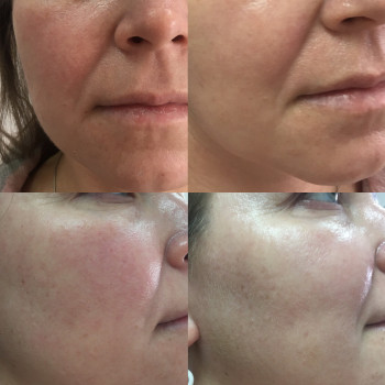 Алёна Неделева, Миколаїв Фото - 81