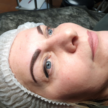 Фото одразу після процедури