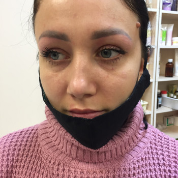 Фотографія «до»