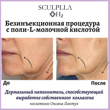 Sculplla + h2
                    Косметолог Оксана Киев