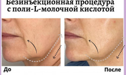 Sculplla + h2 Косметолог Оксана Київ