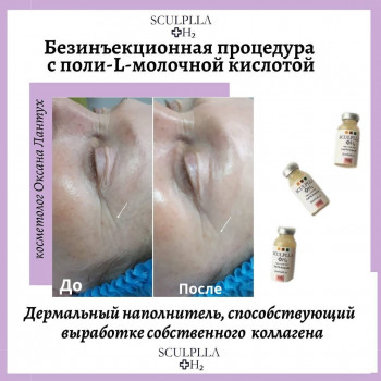 Sculplla + h2
                    Косметолог Оксана Киев