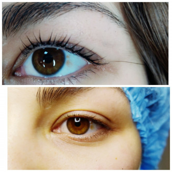 Ламинирование ресниц