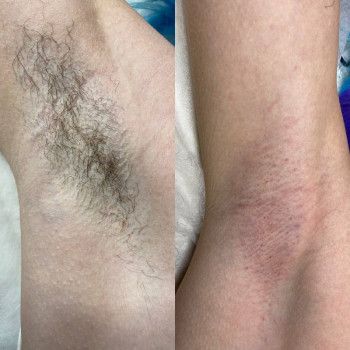 Мария Джусенко, Одеса Фото - 11