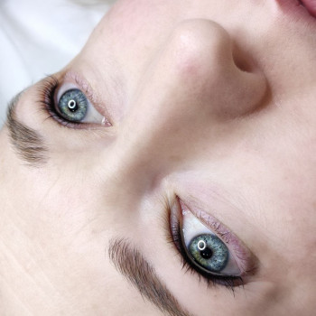 Межресничка