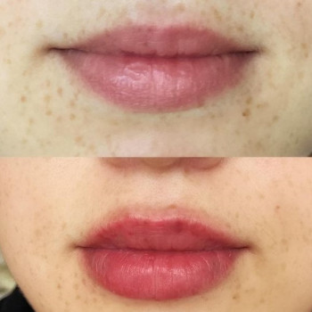 Людмила Грицак, Трускавец Фото - 5