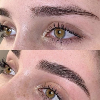 Фото до/после