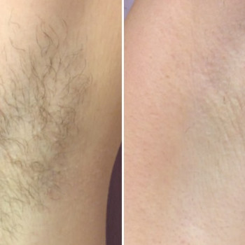 Мариная Хижняк, Запорожье Фото - 7