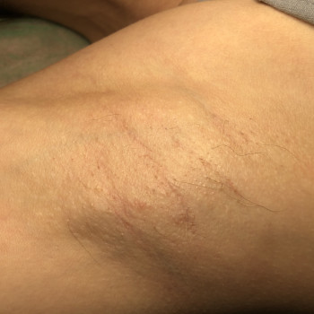 Электроэпиляция
                    Майстер депіляції Lucy Харків