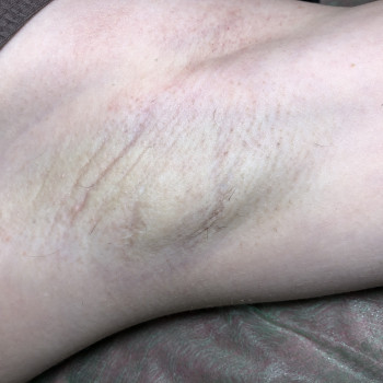 Электроэпиляция
                    Майстер депіляції Lucy Харків