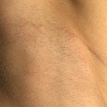 Электроэпиляция
                    Майстер депіляції Lucy Харків