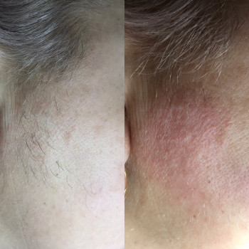 Юлия Турубарова, Мелітополь Фото - 13