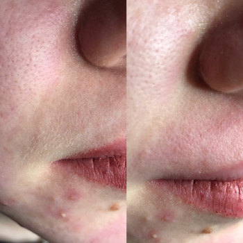 Юлия Турубарова, Мелітополь Фото - 14