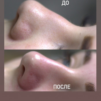 Дарья Кись, Харків Фото - 7