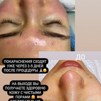 Дарья Кись, Харків Фото - 9