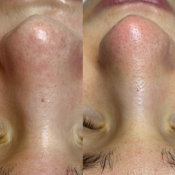 Дарья Кись, Харків Фото - 10