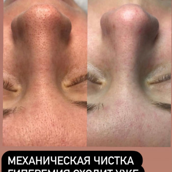 Дарья Кись, Харків Фото - 12