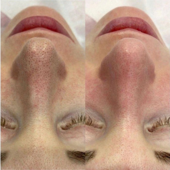 Дарья Кись, Харків Фото - 16