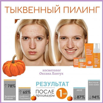 Оксана Лантух, Київ Фото - 15