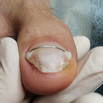 Надія Чечуй, Бровари Фото - 5