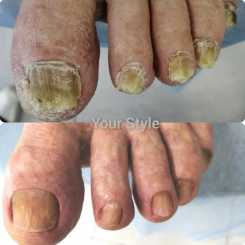 Надія Чечуй, Бровари Фото - 6