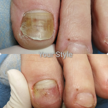 Надія Чечуй, Бровари Фото - 11