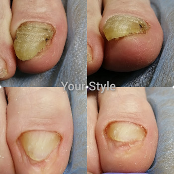 Надія Чечуй, Бровари Фото - 12