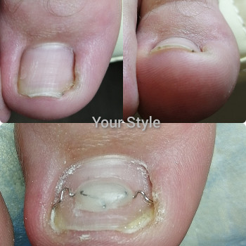 Надія Чечуй, Бровари Фото - 13