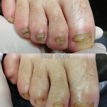 Надія Чечуй, Бровари Фото - 14