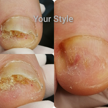 Надія Чечуй, Бровари Фото - 15