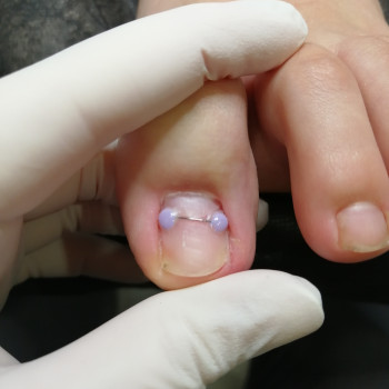 Надія Чечуй, Бровари Фото - 16