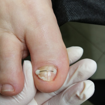 Надія Чечуй, Бровари Фото - 17