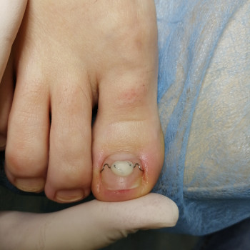 Надія Чечуй, Бровари Фото - 19