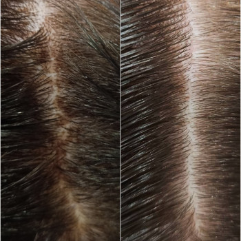 Пилинг кожи головы
                    Парикмахер-колорист Ирина Киев