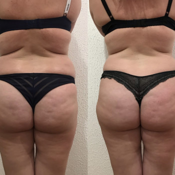 Юлія Сіренко, Полтава Фото - 14