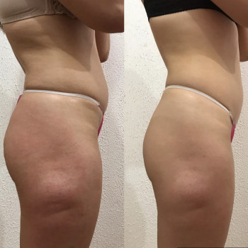 Юлія Сіренко, Полтава Фото - 18