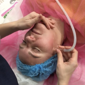 Вакуумный/вакуумно-роликовый/комби массаж лица
                    Массажист Юлия Полтава