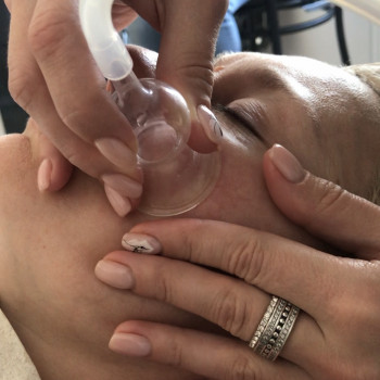 Вакуумный/вакуумно-роликовый/комби массаж лица
                    Массажист Юлия Полтава