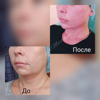 Наталия Мартыненко, Сумы Фото - 58