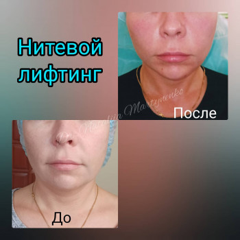 Наталия Мартыненко, Сумы Фото - 62