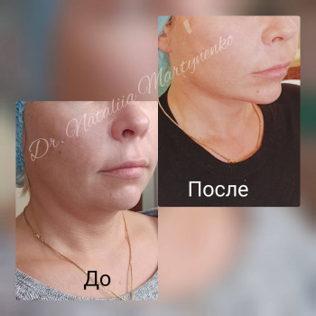 Наталия Мартыненко, Сумы Фото - 65