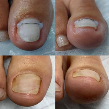 Анастасия Черевко, Токмак Фото - 6