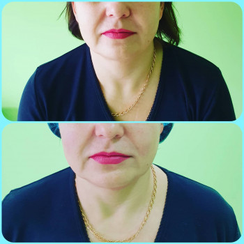 Сергій Савін, Запоріжжя Фото - 29