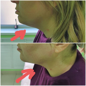 Сергій Савін, Запоріжжя Фото - 30