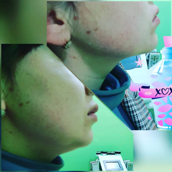 Сергій Савін, Запоріжжя Фото - 31