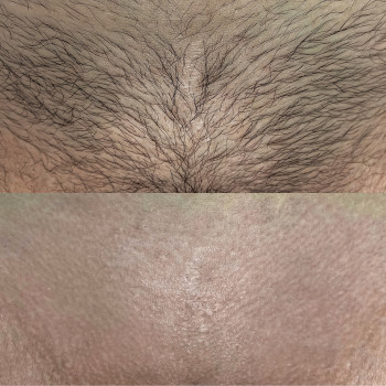 Марина Лихолат, Запорожье Фото - 13