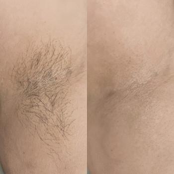 Марина Лихолат, Запорожье Фото - 14