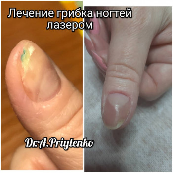 Анастасия Прийтенко, Днепр Фото - 12