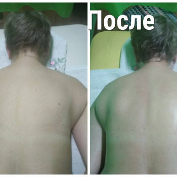 10 сеансов массажа ШВЗ